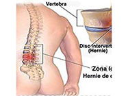 Centrul Preoteasa Kinetoterapie