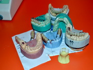 Aparat dentar pentru copii