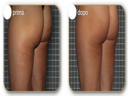 Salon infrumusetare Perfect Contur