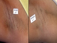 Salon infrumusetare Perfect Contur