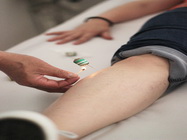 Clinica Shanghai acupunctura