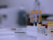 Laborator Analize Borrelia Centrum