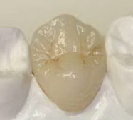 Best Dental Tehnica dentara