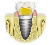 Best Dental Tehnica dentara