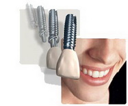 Best Dental Tehnica dentara