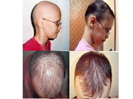 Clinica intoxicatii metale grele