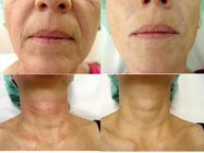 Clinica detoxifiere Bucuresti