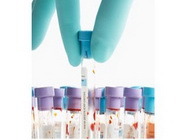 Analize laborator imunologie