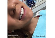 iDent Total Care Agricultori