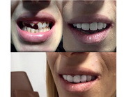 iDent Total Care Agricultori