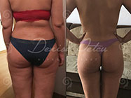 Cabinet Hipnoterapie Denisa Petcu