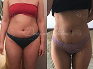 Cabinet Hipnoterapie Denisa Petcu