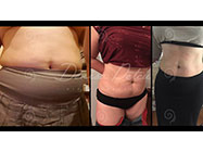 inel gastric virtual sector 3