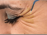 DERM Aesthetic French Center