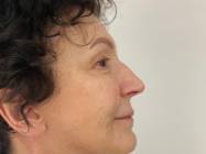 Dr Banacu Luminita - Chirurgie Estetica