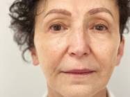 Dr Banacu Luminita - Chirurgie Estetica