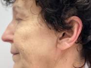 Dr Banacu Luminita - Chirurgie Estetica