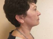 Dr Banacu Luminita - Chirurgie Estetica