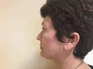 Dr Banacu Luminita - Chirurgie Estetica