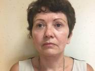 Lipoabdominoplastie Bucuresti