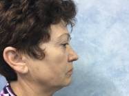 Dr Banacu Luminita - Chirurgie Estetica