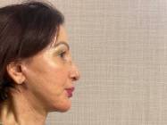 Dr Banacu Luminita - Chirurgie Estetica