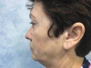 Dr Banacu Luminita - Chirurgie Estetica