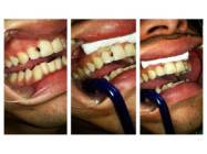 Proteze dentare Drumul Taberei