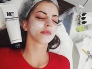 Rejuvenare faciala decebal