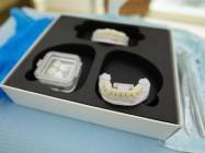  Aparat dentar  piata muncii