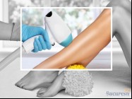 Epilare definitiva laser Gara de Nord