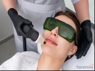 Epilare definitiva laser Gara de Nord