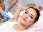 Epilare definitiva laser Gara de Nord