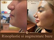 clinica altezza estetica