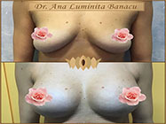 clinica altezza estetica