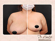 interventii minim invazive