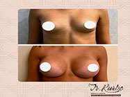 interventii minim invazive