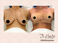 interventii minim invazive dr Kurbe