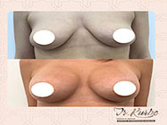 interventii minim invazive dr Kurbe