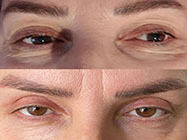 estetica minim invaziva