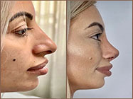 estetica minim invaziva