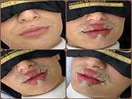 estetica minim invaziva dr Kurbe