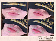 estetica minim invaziva dr Kurbe