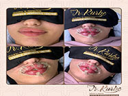 estetica minim invaziva dr Kurbe bucuresti