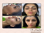estetica minim invaziva dr Kurbe bucuresti