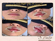 estetica minim invaziva dr Kurbe bucuresti sector ...