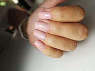 epilare definitiva Militari