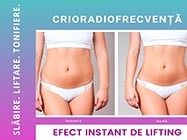 lifting corporal piata Romana