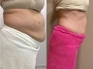 tratamente corporale eximia mogosoaia