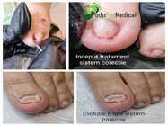 pedichiura-medicala-podpedmedical